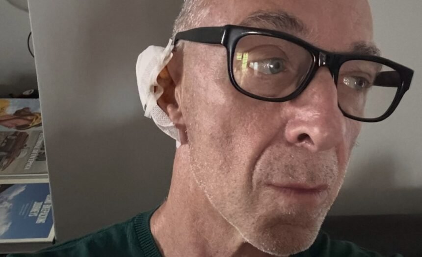 “Speravo di cavarmela con un cerottino e invece…”: Linus svela di avere un tumore della pelle, guarda - Gossip.it