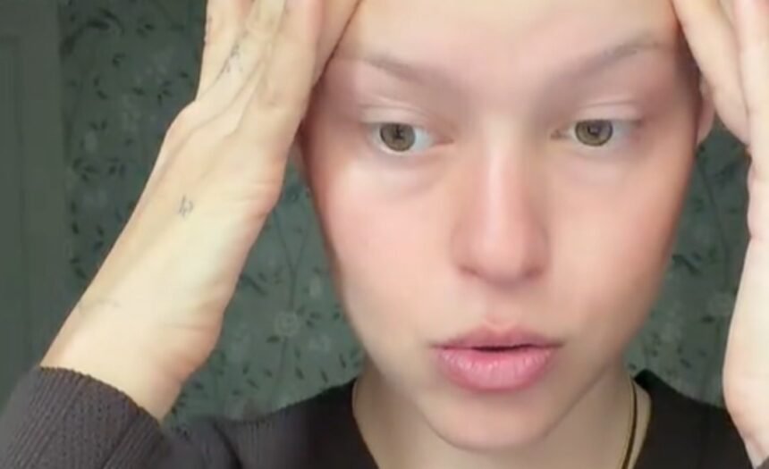 “Non sono la malattia”: Natalia Paragoni torna a parlare della lotta contro il linfoma di Hodgkin e svela come sta - Gossip.it